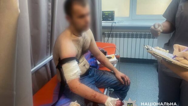 Чоловіка застрелили в Запоріжжі після нападу з ножем на поліцію
